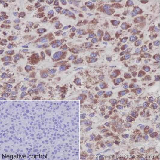 Immunohistochemistry (Formalin/PFA-fixed paraffin-embedded sections) - Anti-NDUFS6 antibody [EPR15957] (ab195807), expandable thumbnail