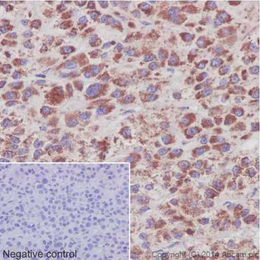Immunohistochemistry (Formalin/PFA-fixed paraffin-embedded sections) - Anti-NDUFS6 antibody [EPR15957] (AB195807)