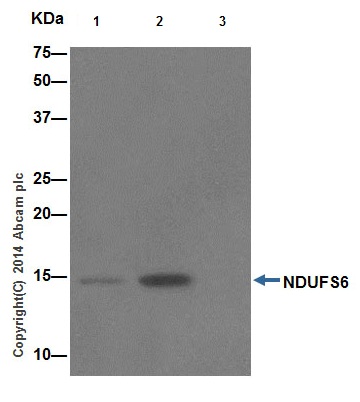 Immunoprecipitation - Anti-NDUFS6 antibody [EPR15957] (ab195807), expandable thumbnail