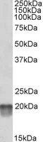 Western blot - Anti-NDUFS7 antibody (AB105025)
