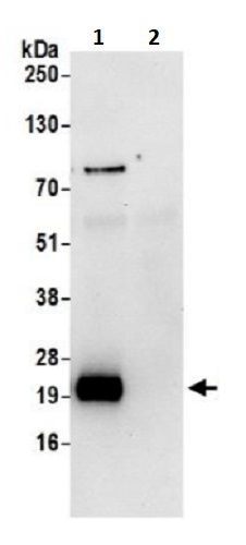 Immunoprecipitation - Anti-NDUFS8 antibody (AB241346), expandable thumbnail