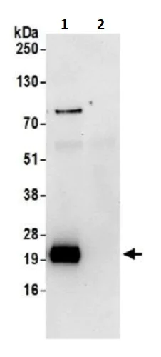 Immunoprecipitation - Anti-NDUFS8 antibody (AB241346)
