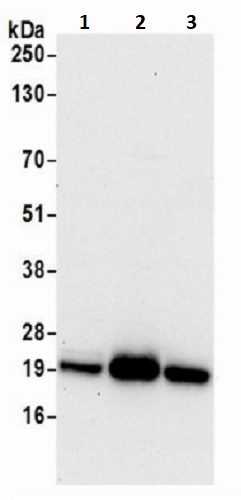 Western blot - Anti-NDUFS8 antibody (AB241346), expandable thumbnail