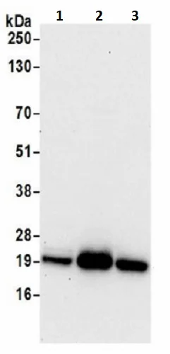 Western blot - Anti-NDUFS8 antibody (AB241346)