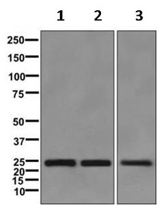 Western blot - Anti-NDUFS8 antibody [EPR11892] - BSA and Azide free (AB249605), expandable thumbnail