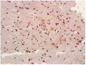 Immunohistochemistry (Formalin/PFA-fixed paraffin-embedded sections) - Anti-NDUFV1 antibody (AB203208)