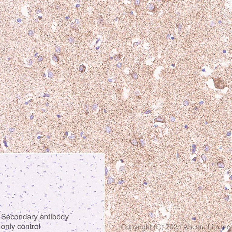 Immunohistochemistry (Formalin/PFA-fixed paraffin-embedded sections) - Anti-NDUFV1 antibody [EPR29179-78] (AB321893)