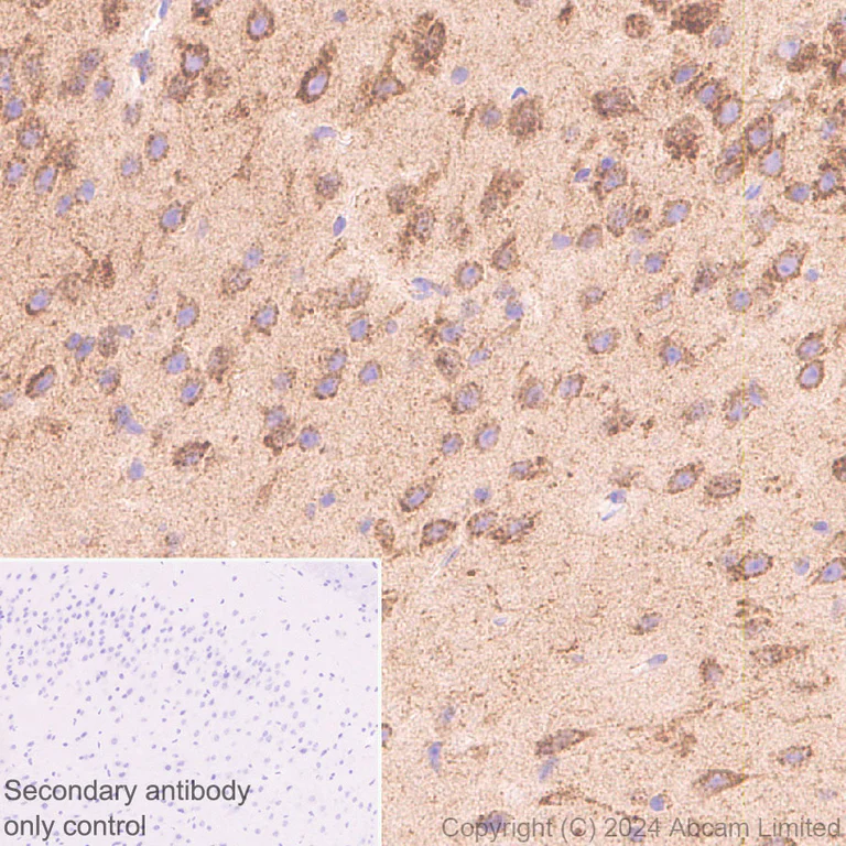 Immunohistochemistry (Formalin/PFA-fixed paraffin-embedded sections) - Anti-NDUFV1 antibody [EPR29179-78] (AB321893)