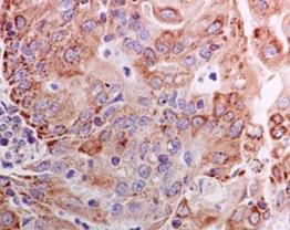 Immunohistochemistry (Formalin/PFA-fixed paraffin-embedded sections) - Anti-NDUFV2 antibody [EPR15350(B)] (AB183717)