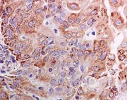 Immunohistochemistry (Formalin/PFA-fixed paraffin-embedded sections) - Anti-NDUFV2 antibody [EPR15350(B)] (AB183717)