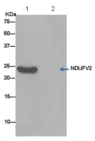Immunoprecipitation - Anti-NDUFV2 antibody [EPR15350(B)] (AB183717)