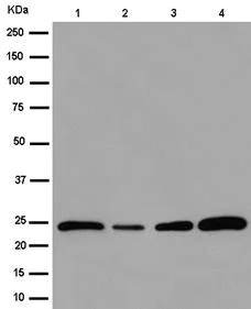 Western blot - Anti-NDUFV2 antibody [EPR15350(B)] (AB183717)
