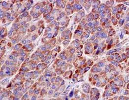 Immunohistochemistry (Formalin/PFA-fixed paraffin-embedded sections) - Anti-NDUFV2 antibody [EPR15351(B)] (AB183715)