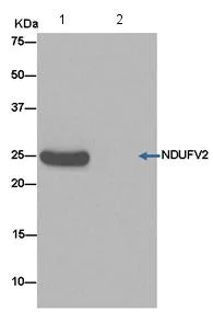 Immunoprecipitation - Anti-NDUFV2 antibody [EPR15351(B)] (AB183715)