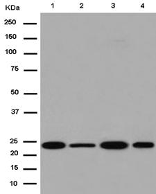 Western blot - Anti-NDUFV2 antibody [EPR15351(B)] (AB183715)