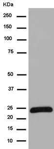 Western blot - Anti-NDUFV2 antibody [EPR15351(B)] (AB183715)