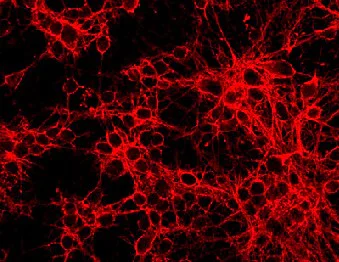 Immunocytochemistry - Anti-NEAS antibody [D8B7] (AB11755)