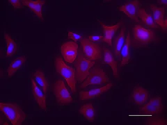 Immunocytochemistry - Anti-NEAS antibody [D8B7] (AB11755)