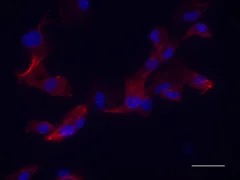 Immunocytochemistry - Anti-NEAS antibody [D8B7] (AB11755)
