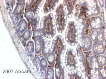 Immunohistochemistry (Formalin/PFA-fixed paraffin-embedded sections) - Anti-NEAS antibody [D8B7] (AB11755)
