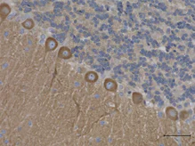 Immunohistochemistry (Formalin/PFA-fixed paraffin-embedded sections) - Anti-NEAS antibody [D8B7] (AB11755)