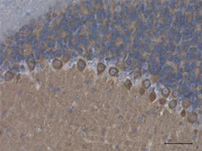 Immunohistochemistry (Formalin/PFA-fixed paraffin-embedded sections) - Anti-NEAS antibody [D8B7] (AB11755)