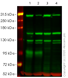 Western blot - Anti-NEAS antibody [EPR3017] (AB75755), expandable thumbnail