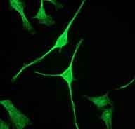 Immunocytochemistry/ Immunofluorescence - Anti-NEAS antibody [EPR3830-43] (AB133320)