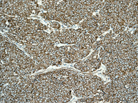 Immunohistochemistry (Formalin/PFA-fixed paraffin-embedded sections) - Anti-NEAS antibody [EPR3830-43] (AB133320)