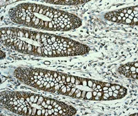 Immunohistochemistry (Formalin/PFA-fixed paraffin-embedded sections) - Anti-NEAS antibody [EPR3830-43] - BSA and Azide free (AB248472)