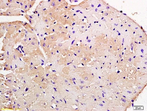Immunohistochemistry (Formalin/PFA-fixed paraffin-embedded sections) - Anti-Nebulette antibody (AB214377)