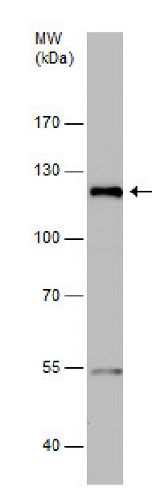 Western blot - Anti-Nebulette antibody - C-terminal (AB229312)