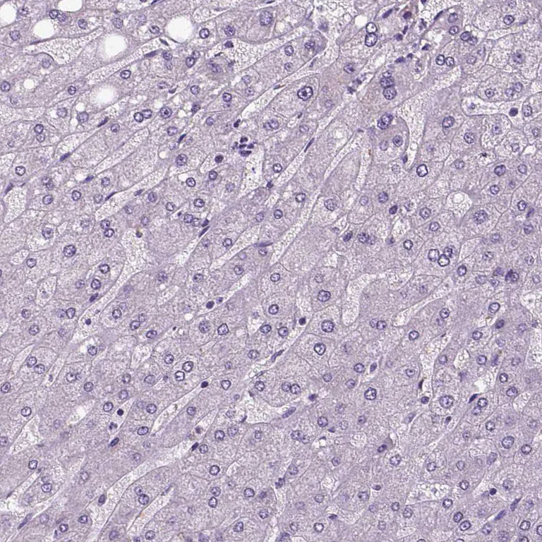 Immunohistochemistry (Formalin/PFA-fixed paraffin-embedded sections) - Anti-NECAB1 antibody (AB224450)