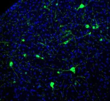 Immunohistochemistry (Formalin/PFA-fixed paraffin-embedded sections) - Anti-NECAB1 antibody (AB224450)