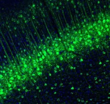 Immunohistochemistry (Formalin/PFA-fixed paraffin-embedded sections) - Anti-NECAB1 antibody (AB224450)