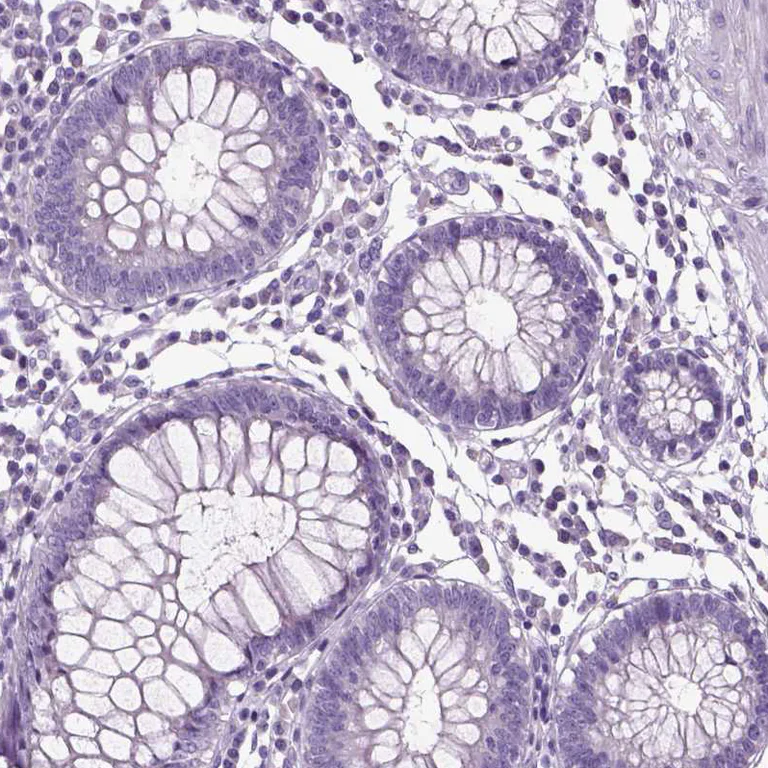 Immunohistochemistry (Formalin/PFA-fixed paraffin-embedded sections) - Anti-NECAB1 antibody (AB224450)