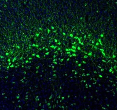 Immunohistochemistry (Formalin/PFA-fixed paraffin-embedded sections) - Anti-NECAB1 antibody (AB224450)