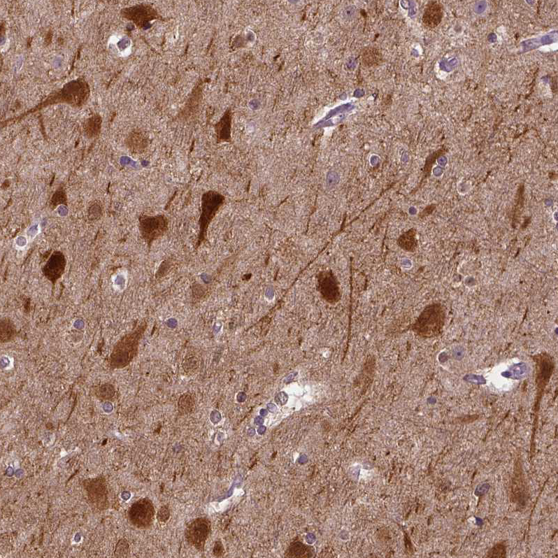 Immunohistochemistry (Formalin/PFA-fixed paraffin-embedded sections) - Anti-NECAB1 antibody (AB224450)