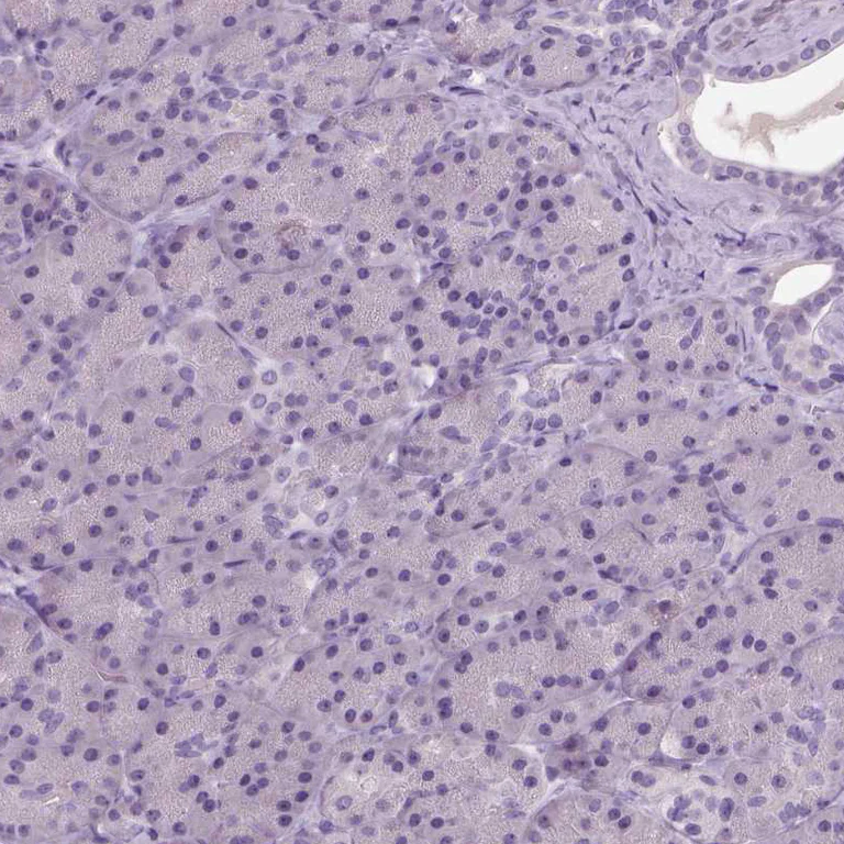 Immunohistochemistry (Formalin/PFA-fixed paraffin-embedded sections) - Anti-NECAB1 antibody (AB224450)