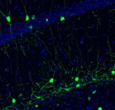 Immunohistochemistry (Formalin/PFA-fixed paraffin-embedded sections) - Anti-NECAB1 antibody (AB224450)