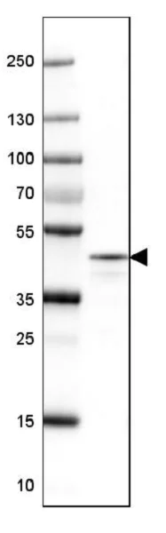Western blot - Anti-NECAB1 antibody (AB224450)