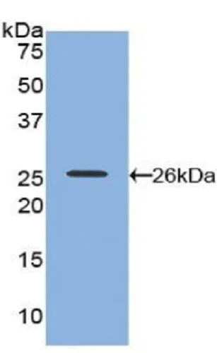 Western blot - Anti-Nectin 2 antibody (AB233085)