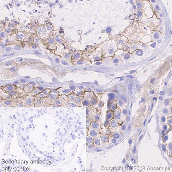 Immunohistochemistry (Formalin/PFA-fixed paraffin-embedded sections) - Anti-Nectin 2 antibody [EPR21124] - BSA and Azide free (AB239346)