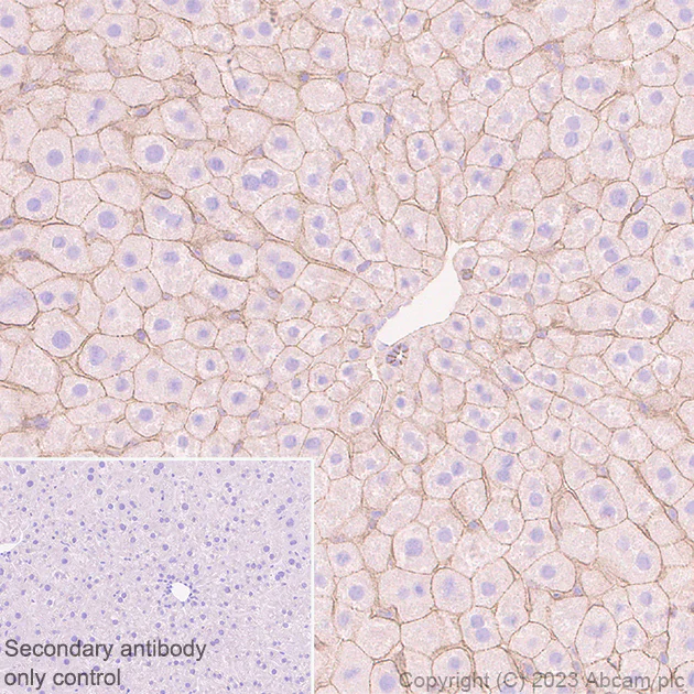 Immunohistochemistry (Formalin/PFA-fixed paraffin-embedded sections) - Anti-Nectin 2 antibody [EPR28277-22] (AB314229)