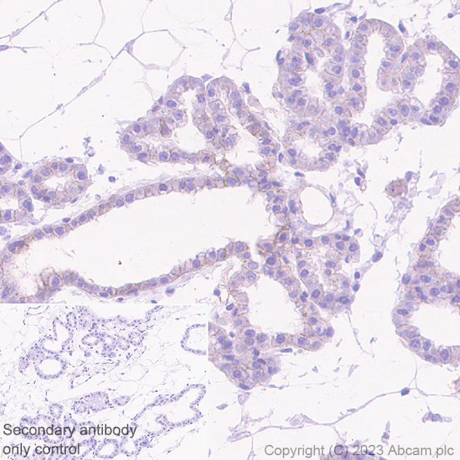 Immunohistochemistry (Formalin/PFA-fixed paraffin-embedded sections) - Anti-Nectin 2 antibody [EPR28277-22] (AB314229)