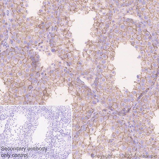 Immunohistochemistry (Formalin/PFA-fixed paraffin-embedded sections) - Anti-Nectin 2 antibody [EPR28277-22] - BSA and Azide free (AB314230)