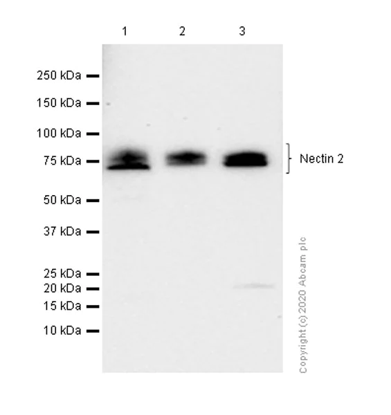Western blot - Anti-Nectin 2 antibody [EPR6717] (AB135246)