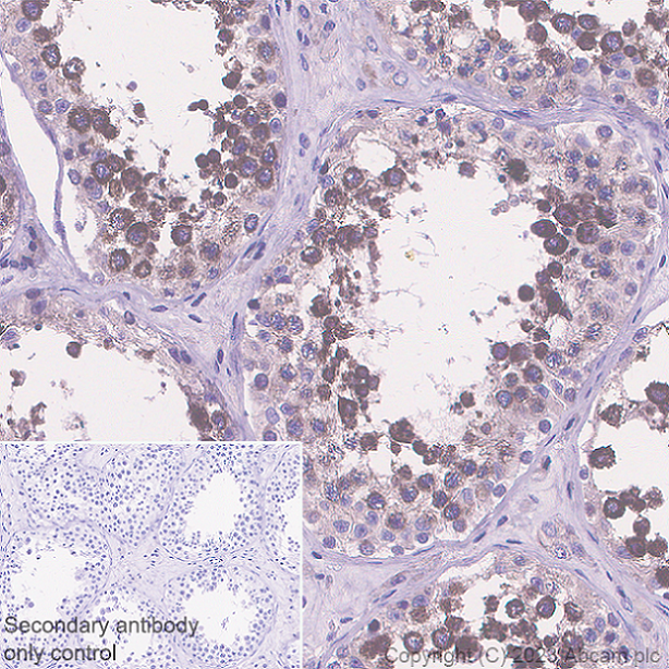 Immunohistochemistry (Formalin/PFA-fixed paraffin-embedded sections) - Anti-Nectin 3 antibody [EPR26326-22] - BSA and Azide free (AB314220), expandable thumbnail