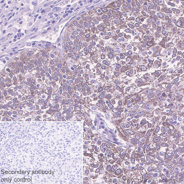 Immunohistochemistry (Formalin/PFA-fixed paraffin-embedded sections) - Anti-Nectin 3 antibody [EPR26326-22] - BSA and Azide free (ab314220), expandable thumbnail