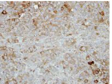 Immunohistochemistry (Formalin/PFA-fixed paraffin-embedded sections) - Anti-Nectin-4 antibody (AB155692)